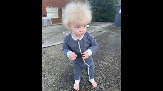 Один на миллион в Америке обнаружен мальчик с синдромом нерасчесываемых волос. смотреть онлайн