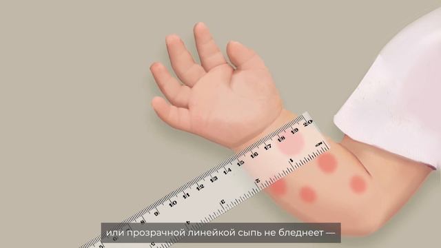 Красные флаги смотреть онлайн