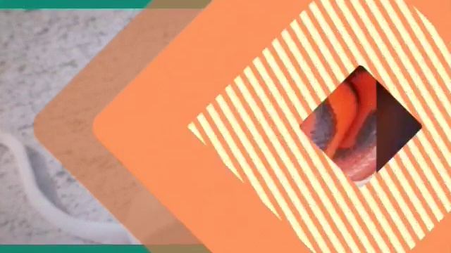 Самые красивые змеи смотреть онлайн