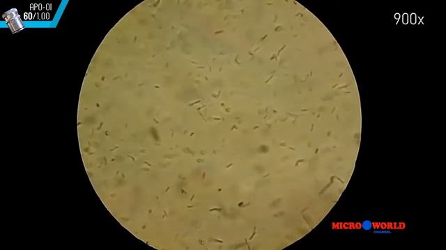 Старый желатиновый бульон под микроскопом - MICRO WORLD #12