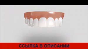Обзор Snap On Smile съемные виниры реальные отзывы, накладные виниры цена, купить, инструкция