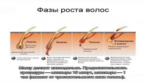 Линия роста волос на лбу: что это такое и можно ли ее скорректировать