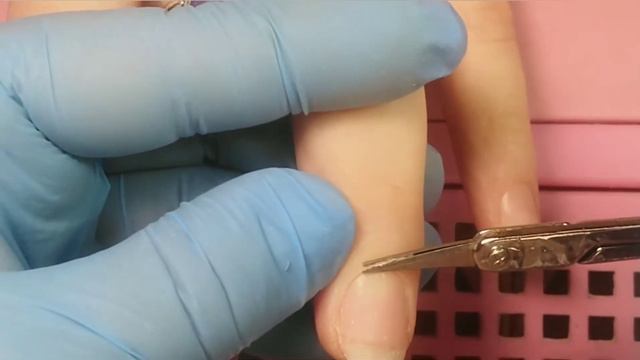 Особо чувствительная кутикула. 2. смотреть онлайн