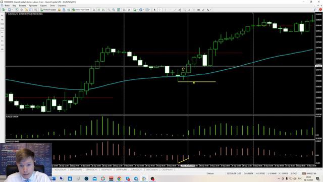 Рентген Александра Элдера  - торговая стратегия.