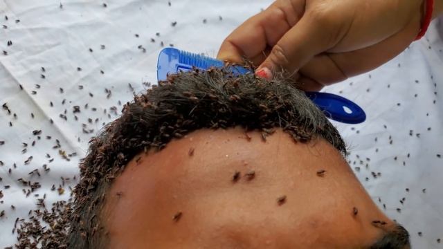 Remove Lice On Sad Boy's Head #002