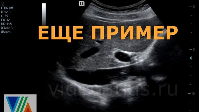 Кава-фильтр смотреть онлайн