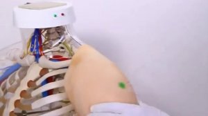 Внутримышечные инъекции в мышцу плеча