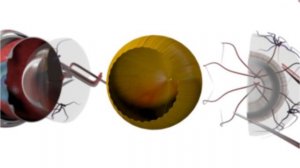 ГЛАЗ КАК ОПТИЧЕСКАЯ СИСТЕМА