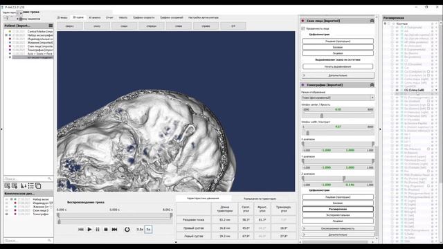 17. Построение сферы Монсона. смотреть онлайн