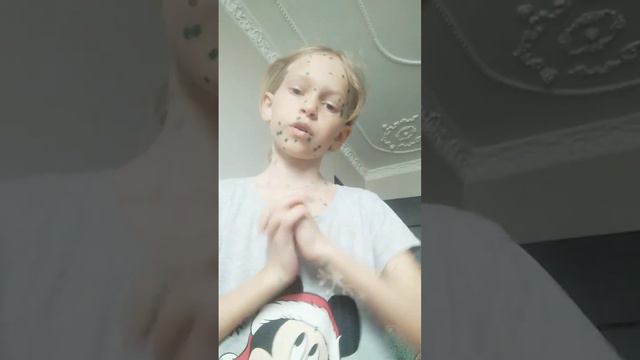 я заболела ветрянкой. У меня есть температура и болит голова смотреть онлайн