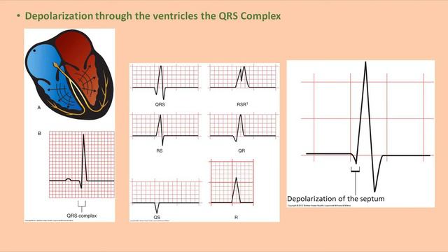 ECG Basics (Part 1)~ Dr. Leonard Ranasinghe (Ph.D., MD) смотреть онлайн