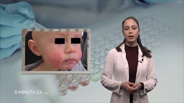 5 minuta za medicinu - Rubela peta i šesta bolest смотреть онлайн