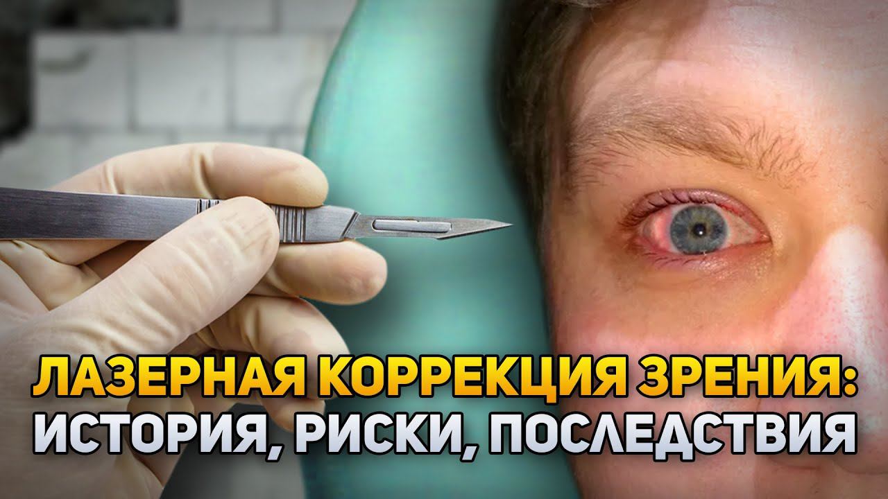 Лазерная коррекция зрения ‒ история, риски, последствия | DeeaFilm смотреть онлайн
