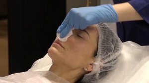 Липолитик HTL-T для коррекции формы носа. Практика