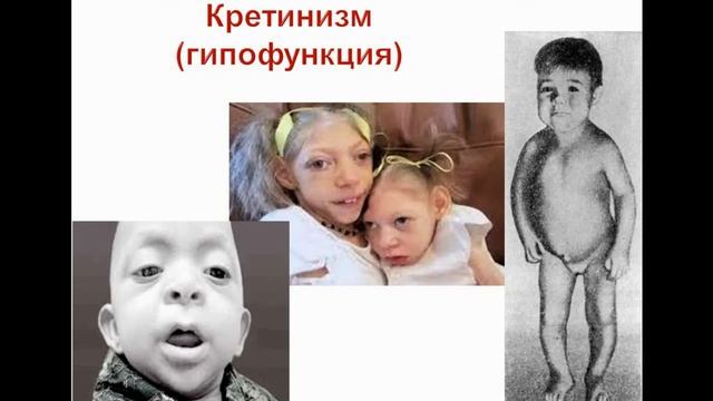 Эндокринная система. Тема 13. Строение и функции щитовидной железы и надпочечников смотреть онлайн