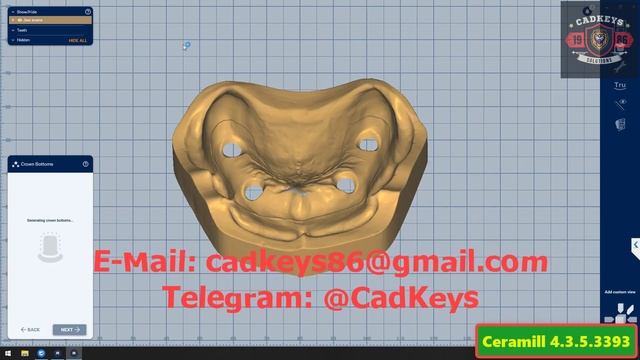 Ceramill Software 4.3.5.3393 смотреть онлайн