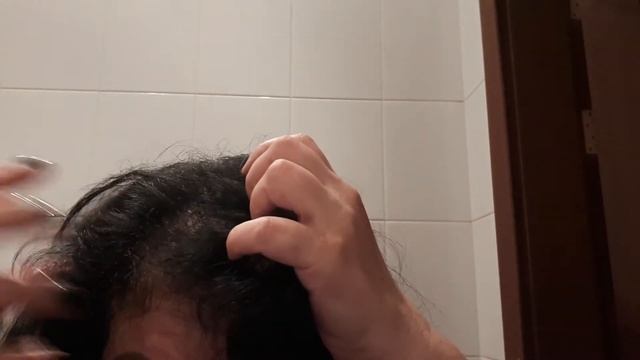 СПРЕЙ ДЛЯ РОСТА ВОЛОС! РАСТУТ ДАЖЕ В МЕСТАХ ПОЛНОГО ОБЛЫСЕНИЯ смотреть онлайн