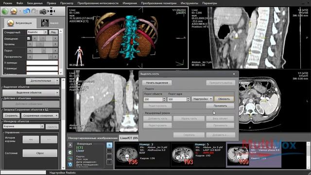 Программа для сегментации костных структур на 3D КТ изображениях смотреть онлайн