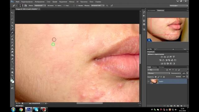 Как убрать прыщи,или дефекты кожи,при помощи фотошопа Ps 6 смотреть онлайн