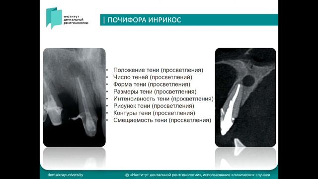 Курасов Д. Н. / Кисты челюстно-лицевой области — 2 смотреть онлайн