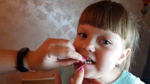 Вырываем молочный зуб дома ниткой.