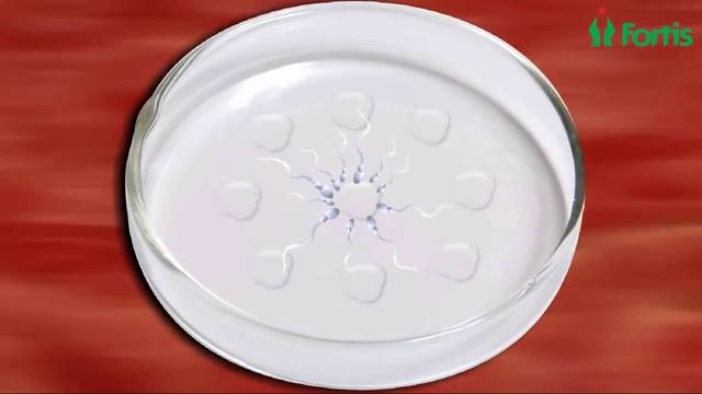 IVF, Fertility Treatment, Assisted Conception, pregnancy, Test Tube Baby смотреть онлайн