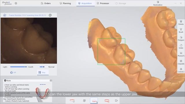 PANDA smart Intraoral Scanner | Restoration Scanning смотреть онлайн