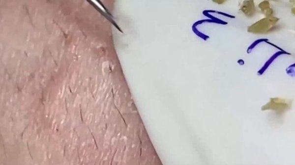 Enjoy Your Day With Hien Nguyen Spa # 1171