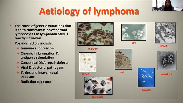 Biology of Lymphoma presented by Dr Samar Issa смотреть онлайн