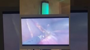 Лапароскопическое удаление кисты почки