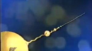 Физиология. Выделительная система человека(почки).