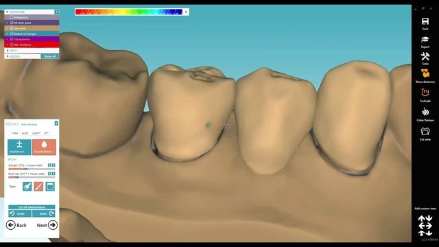 limites labo exocad смотреть онлайн