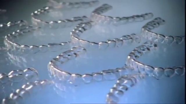 Invisalign Treatment Experience