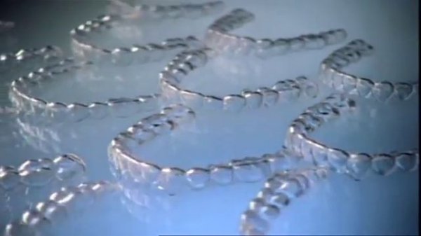 Invisalign treatment experience