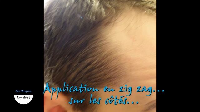 Résultat Vichy Dercos Aminexil Pro - Soin Capillaire Homme