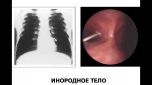 Лекция 10.
Все факультеты.
Дыхательная недостаточность.