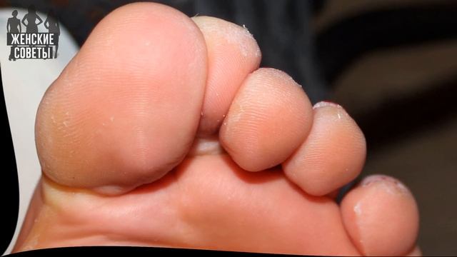 9 удивительных способов применения аспирина, о которых вы никогда наверняка не слышали! смотреть онлайн