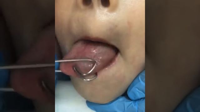 Логопедический массаж в Махачкале в медицинском центре "Лекарь" смотреть онлайн