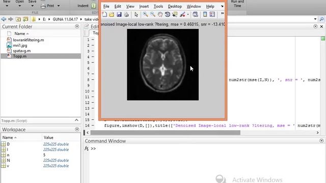 "Improved Low-Rank Filtering of MR Imaging Data Corrupted by Noise смотреть онлайн