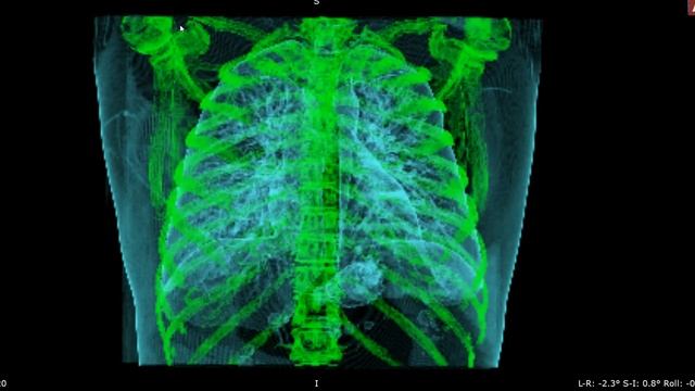 Запись 2020 08 24 21 00 18 410