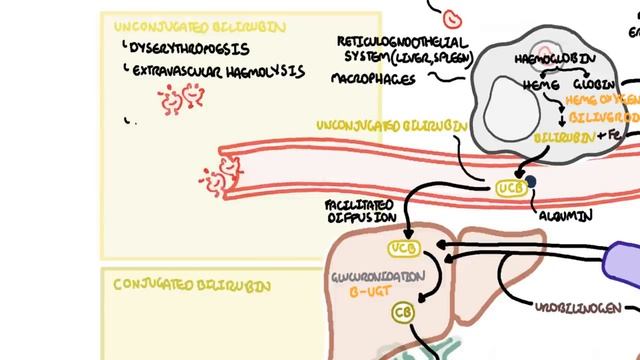 Approach to Jaundice - types and causes of hyperbilirubinemia, investigations.mp4 смотреть онлайн