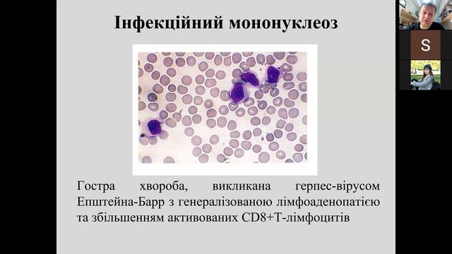 Непухлинна патологія лейкоцитів смотреть онлайн