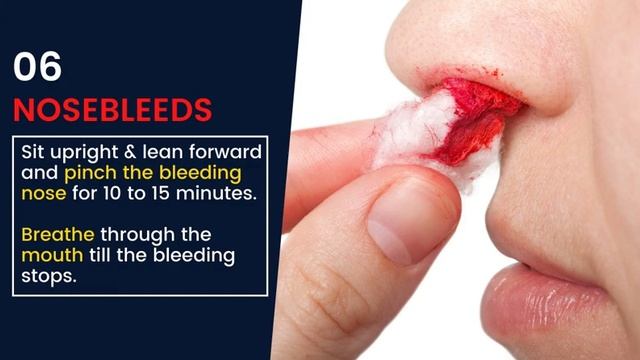 10 Basic First Aid Tips For People at Home смотреть онлайн
