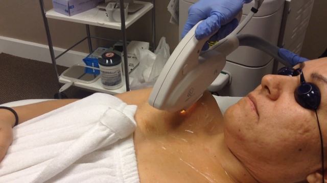 IPL/Laser Rejuvenation смотреть онлайн