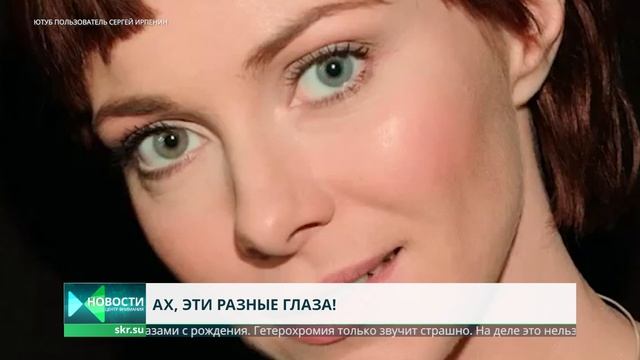Гетерохромия - глаза разного цвета. Что это, как выглядит и почему появляется? смотреть онлайн