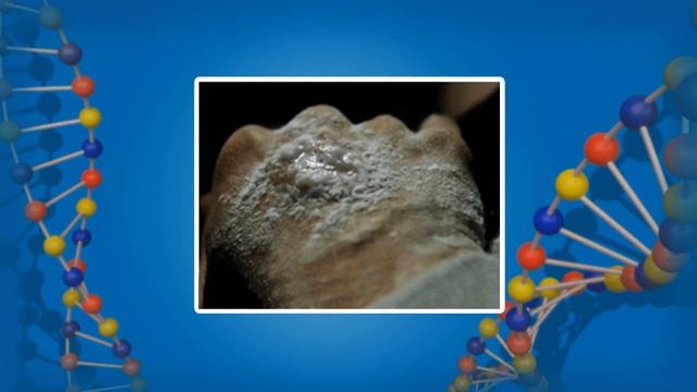 Нарушение кожных покровов и причины повреждения кожи. Видеоурок по биологии 8 класс смотреть онлайн