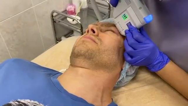 СМАС лифтинг смотреть онлайн