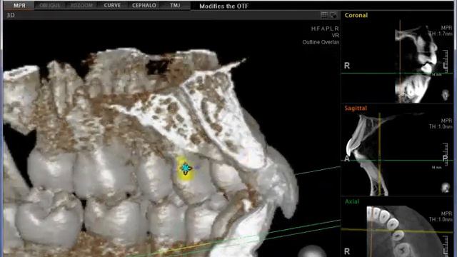 Ez3d2009 3 - я часть смотреть онлайн