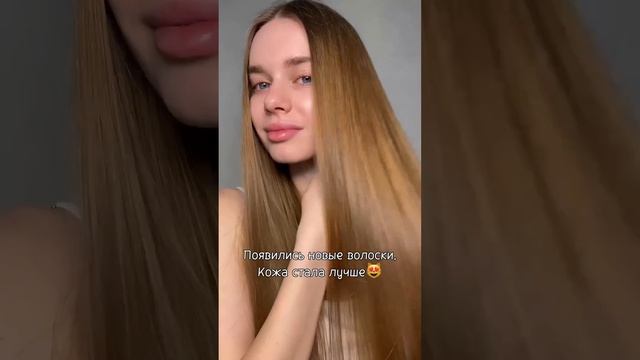 Недавно у меня СЫПАЛИСЬ ВОЛОСЫ, секлись кончики…но после витаминов я стала довольна собой смотреть онлайн