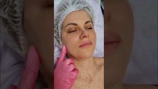Секрет коктейля «Монако» для лица.? смотреть онлайн